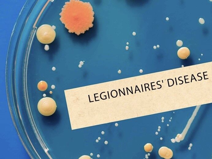 Legionnaires in petri dish